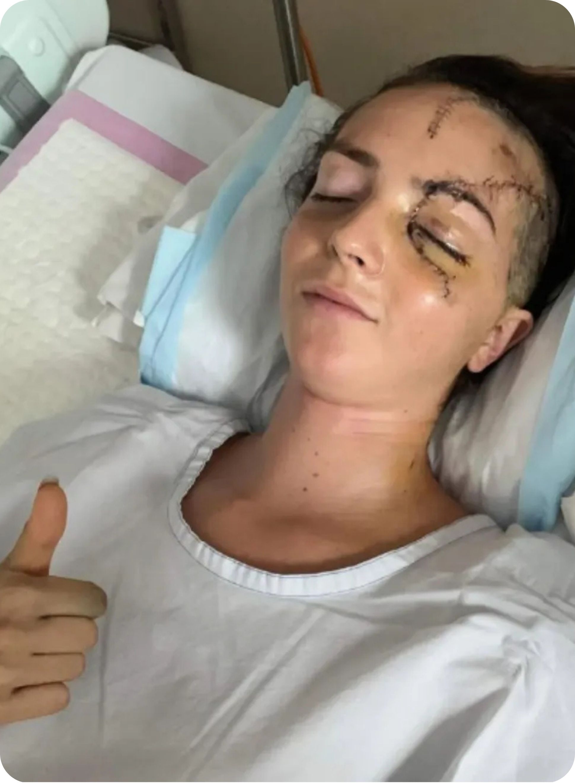 Georgina post surgery
